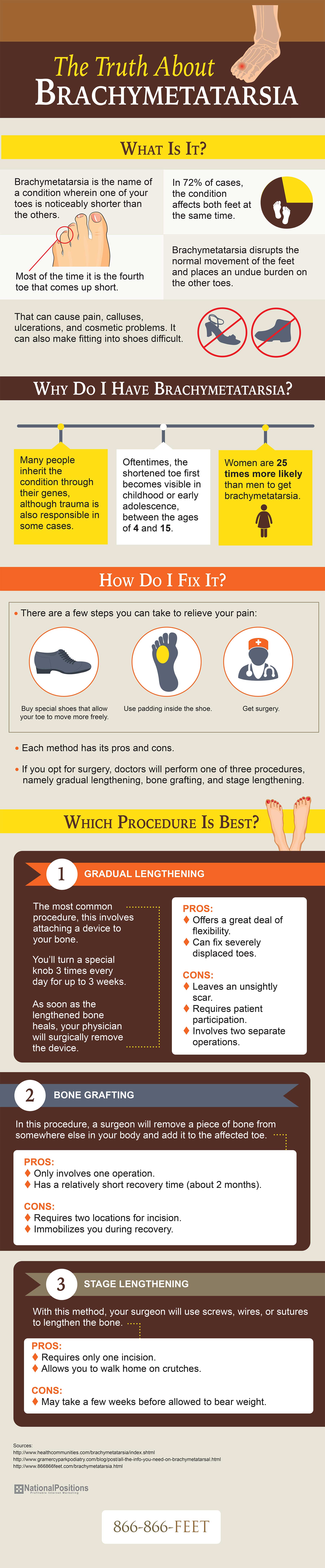 The truth about Brachymetatarsia including therapy and surgical procedures!