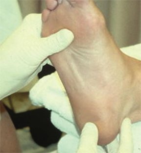 Podiatrist Manipulating Foot